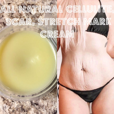 All Natural Scar Cellulite Stretch Mrk Cream